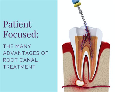 When to Consider Retreatment