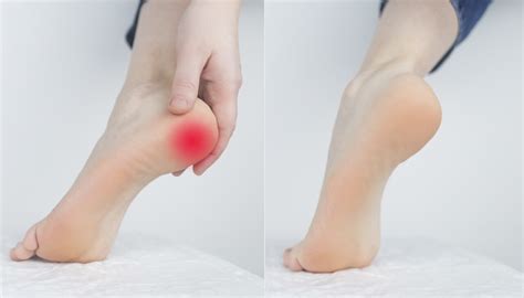 Whiter Feet: 5 Effective Methods
