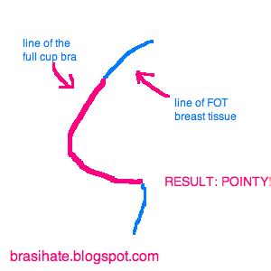 Why Are My Boobs Pointy