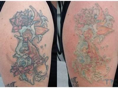 Why Do My Tattoos Look Faded