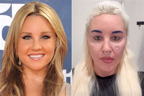 Why Does Amanda Bynes Look Different