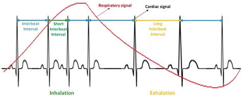 Why Does Heart Rate Decrease In Cold Temperatures
