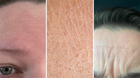 Say Goodbye to Discomfort: Understanding Why Your Skin Feels So Tight!