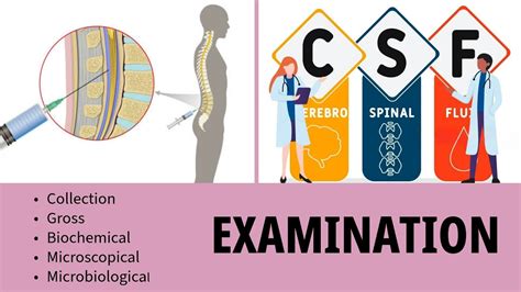 Why Gross Examination Matters