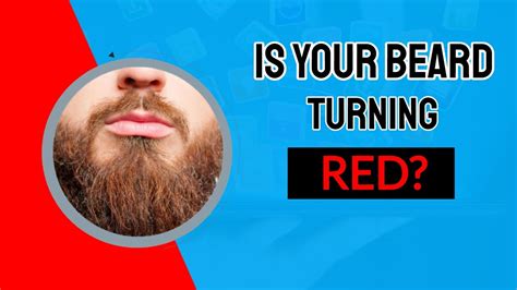 Why Is Beard Hair Red