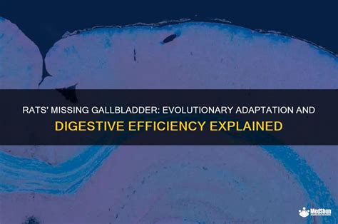 Why Is The Gallbladder Absent In Rats