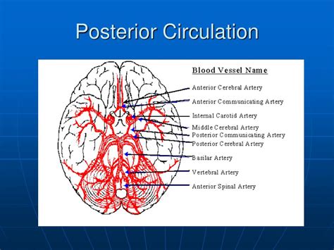 Why Posterior Circulation Matters