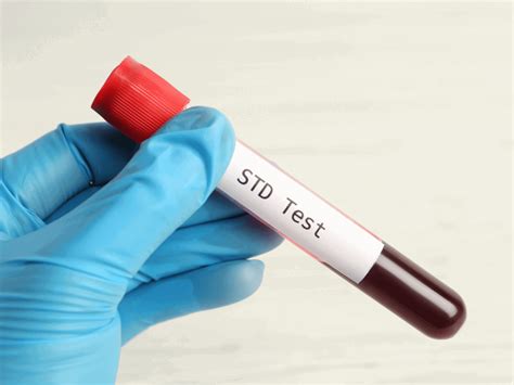 Why STD Testing Is Crucial (Seriously, It Is!)
