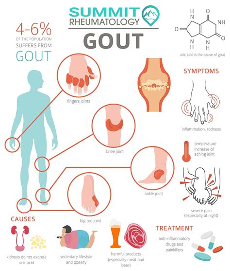 Why You Cannot Ignore Gout Treatment