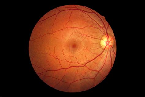 Why You Might Need a Retinal Eye Scan