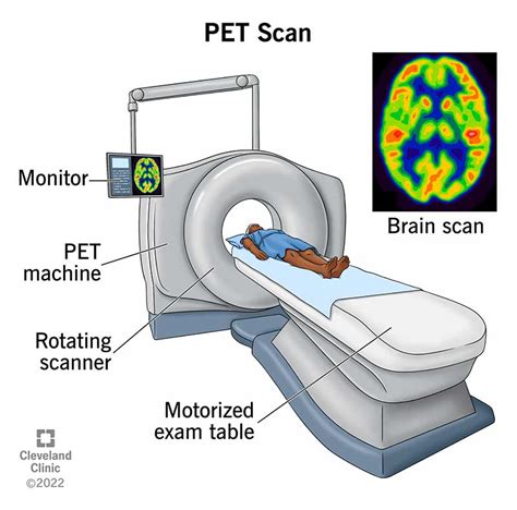 Why Your Doctor Might Order a PET Scan