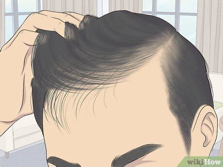 Will I Go Bald Calculator