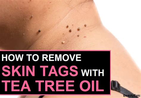 The Miracle of Tea Tree Oil: Kiss Your Skin Tags Goodbye for Good!