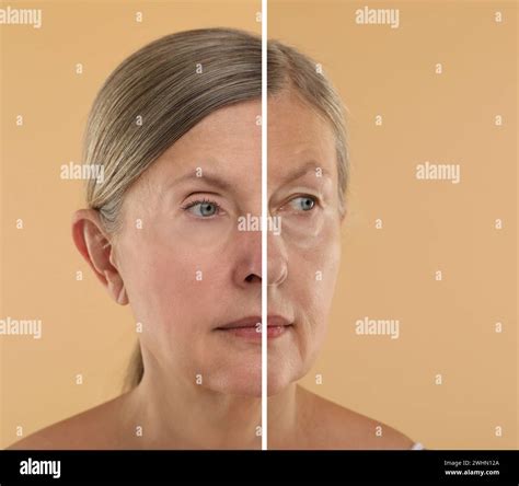 Transforming Her Identity: A Powerful Journey of a Woman Changing Skin Colour