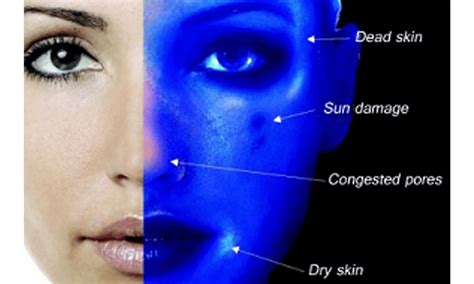 Unlocking Skin Secrets: Exploring Wood's Lamp Analysis Colors