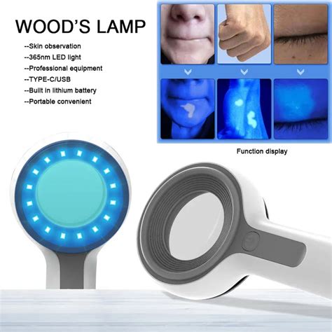 Revamp Your Beauty Game with the Sophisticated Wood Lamp Skin Analyzer - Unveiling Your Radiant Skin Inside Out!