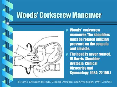 Watch the Fascinating Woods Corkscrew Maneuver in Action: Animated Visual Guide