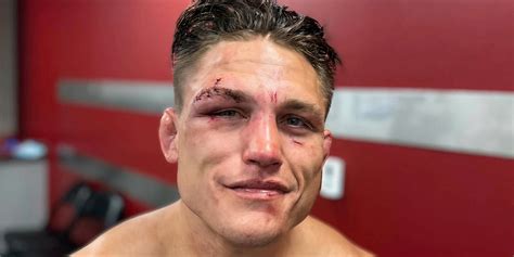 Worst Cuts Ufc