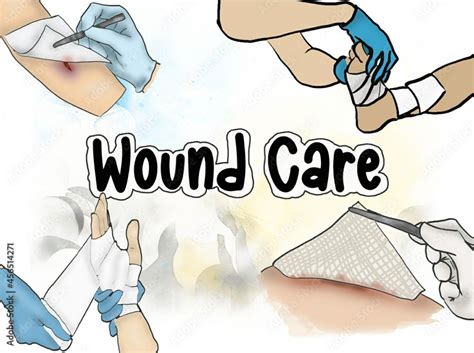 Wound Care