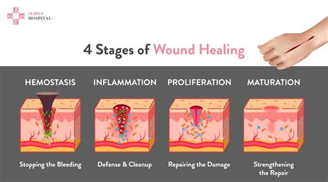 Wound Healing Image