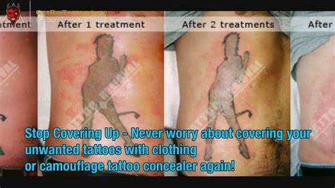Wrecking Balm Tattoo Removal System to Fade Tattoos At