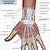 Wrist Muscle Anatomy