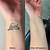 Wrist Tattoo Removal