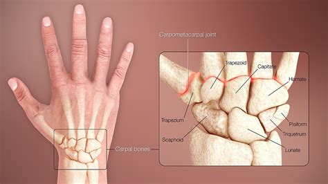 Wrist Bones: Function, Problems & Solutions