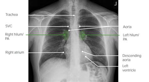 X-ray anatomy illustration