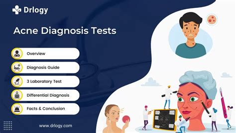 Reveal your Radiance: Y-Our Skin Review for a Flawless Acne-Free Complexion