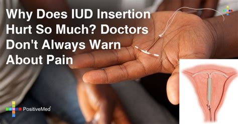 abdominal pain after iud insertion