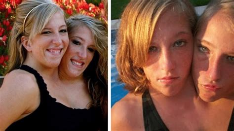 abigail and brittany hensel death