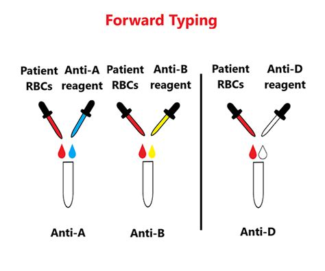 abo forward typing slide method