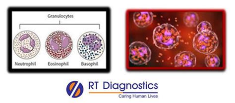 Absolute Granulocyte Count 0.0