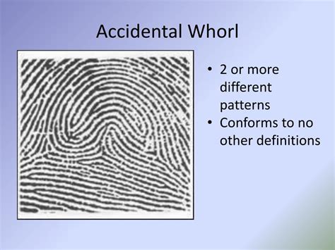 accidental whorl