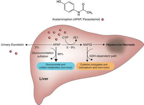 acetaminophen liver toxicity