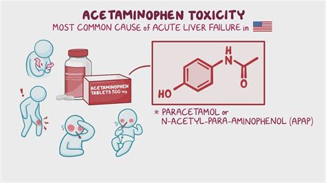 Acetaminophen Poisoning Defined