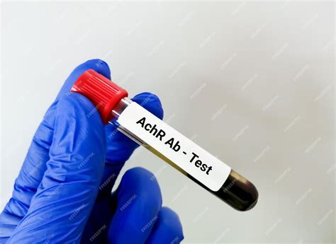 acetylcholine receptor antibodies blood test