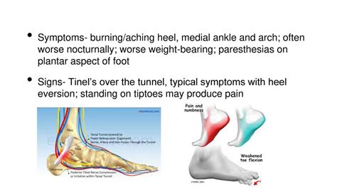 Soothe Your Aching Heel and Ankle: Effective Relief Strategies
