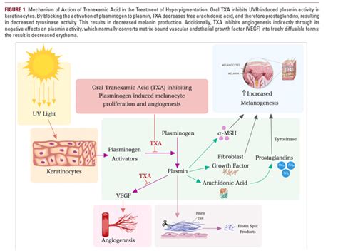 Acids For Melasma