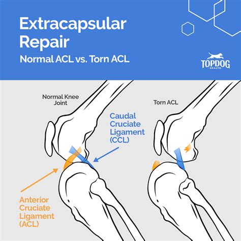 acl tear surgery cost