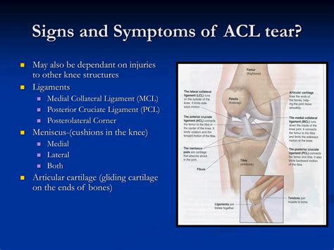 acl tear symptoms and signs