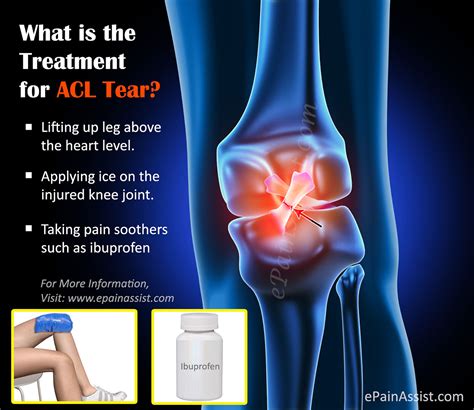 acl tear treatment