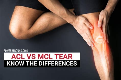 acl vs mcl tear pain location