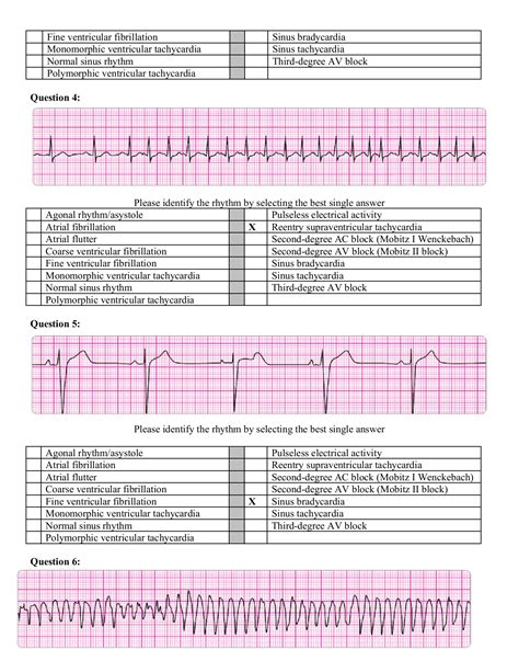 acls pre assessment and pretest