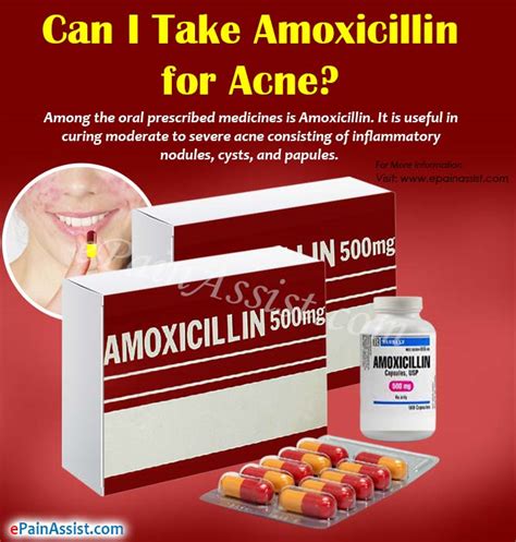Amoxicillin For Acne