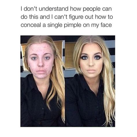 skin still not clear tho idk acne why lol meme Beauty memes