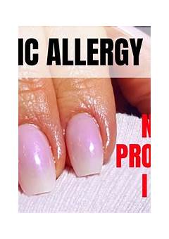 Acrylic Nails Allergic Reaction Treatment