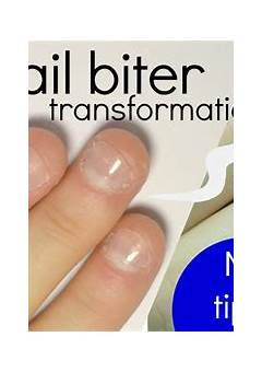 Acrylic Nails For Nail Biters: A Solution For Strong, Beautiful Nails