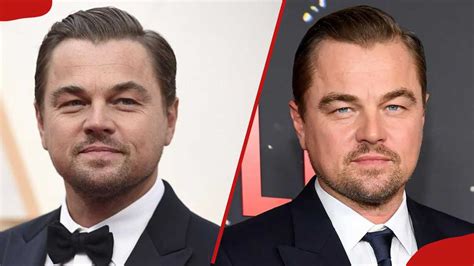 actors with cleft lip